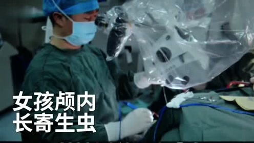 女孩颅内长11cm寄生虫,医生开颅活捉