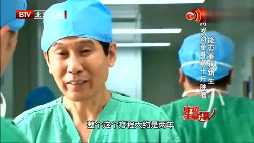 生命缘:很难想象这么大的肿瘤是从一个两岁的宝宝身上取下来的
