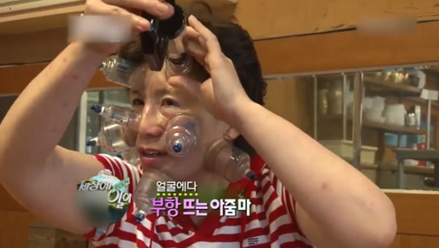 韩国奇葩大妈在脸上拔罐12年 拔罐痕迹惨不忍睹却称是为了美颜