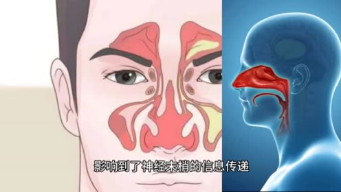 感冒鼻塞不通气怎么办?教你一个小窍门,快速有效通气,很实用!