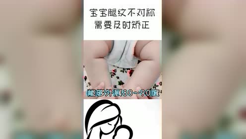 宝宝腿纹不对称,需要及时矫正