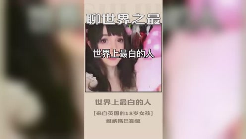 世界上最白的人,维纳斯·巴勒莫有着芭比娃娃般白皙的面孔