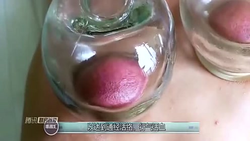 印度人都是怎么拔罐的？小伙作死尝试，画面太喜感！