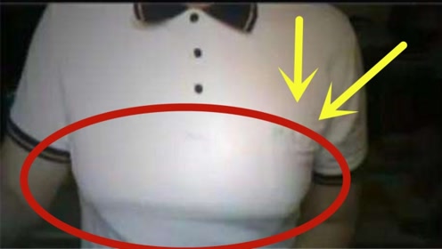 男子胸部发育成c罩杯,吸出1500毫升脂肪,罪魁祸首竟是它?