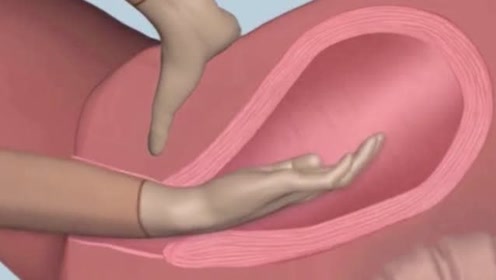 手剥胎盘有多痛?3d动画展示全过程,女人生孩子太不容易!