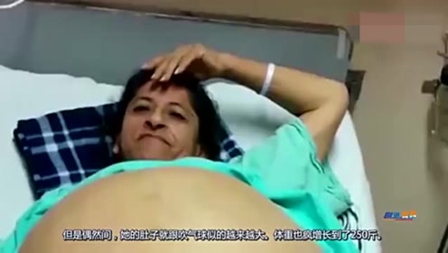 大妈肚子痛却懒得去医院,结果就生了个120斤的"怪物"!