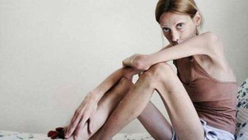 最瘦的女人,身高1米58体重仅20千克,网友:风一吹就能倒