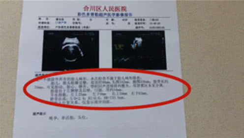 怎样辨认胎儿性别?医生一字不提的秘密,b超数据一看便知!