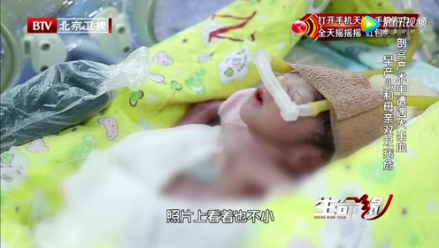 生命缘:看着刚刚出生的小宝宝身上插满救命的管子,妈妈心里满满的都是