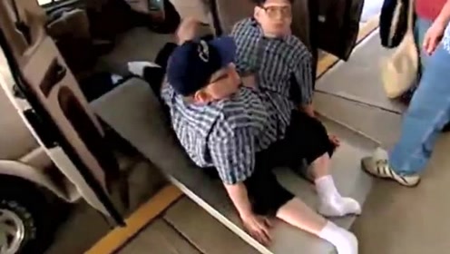 假如连体人其中一个去世,另一个会变成什么样呢,你知道吗?