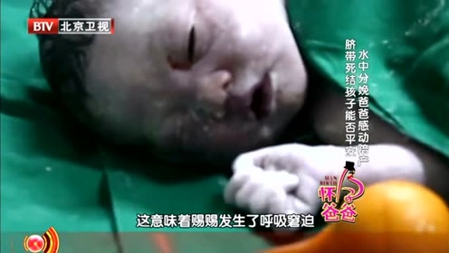 生命缘:宝宝脐带上居然有个死结,怪不得出生后哭了一声就在没有啼哭