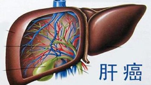 肝癌来临前,这3个症状"贼明显"