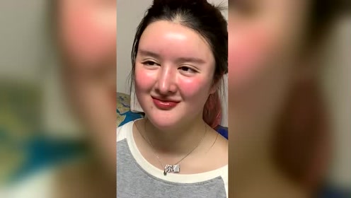 小姐姐痴迷整容,如今这充满玻尿酸的大脸,看着真吓人