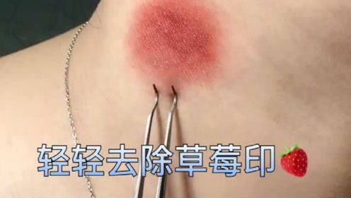 教你去除草莓印的秘诀,这个东西很关键,人人家里都有!
