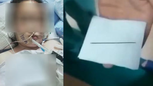 11岁女生心脏取出7厘米钢针,事发于封闭式体校,原因仍未知