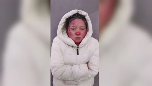 大雪冻伤妆容,非常完美