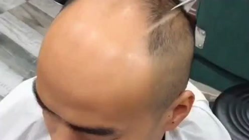 秃顶剪完秒帅变男神,这样的发型你值得拥有,我们理发店见!