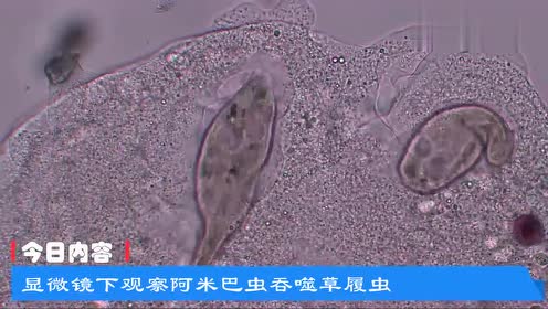 显微镜下观察阿米巴虫吞噬草履虫,原来微观世界也有杀戮