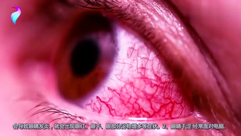 眼睛发出的求救信号,多数人都没在意,别等肝脏有病就晚了!