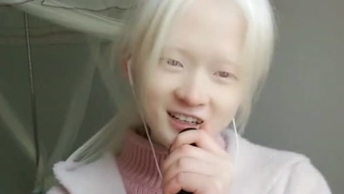 白化病女孩镜头前唱歌,看起来就像小精灵,连睫毛都是白色的