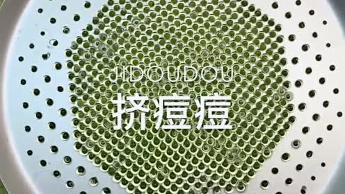 欢迎收看给泥挤痘痘系列,密集恐惧症慎入哦