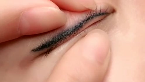 发蓝的美瞳线原来全都要用激光洗,想想就很疼!