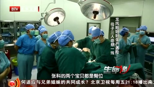 生命缘:肚子中的双胞胎都是臀位,大大增加了医生取出宝宝的困难