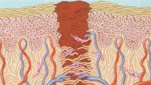 人受伤后伤口是怎么愈合的?动画模拟全过程,场面实在是太震撼