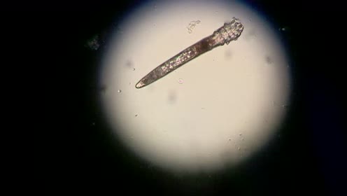 脸上鼻子周围的毛囊虫,人人都有,显微镜下爬啊爬啊